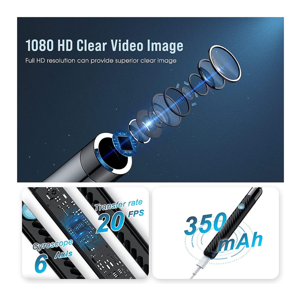 Kit Removedor de Cera Auricular com Câmara 1080P – 8 Peças para Limpeza Segura do Ouvido
